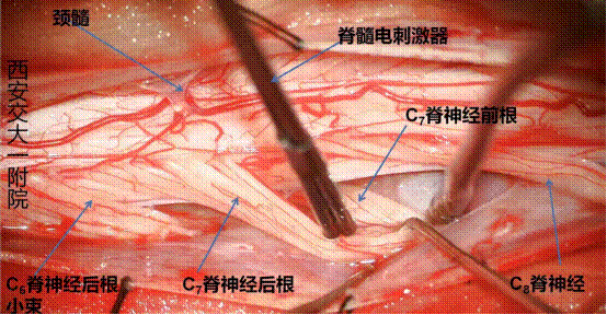 http://www.dyyy.xjtu.edu.cn/__local/4/9F/E3/C122915E73CF8E1BE5BBE98DAAB_8AF123E2_9C274.png