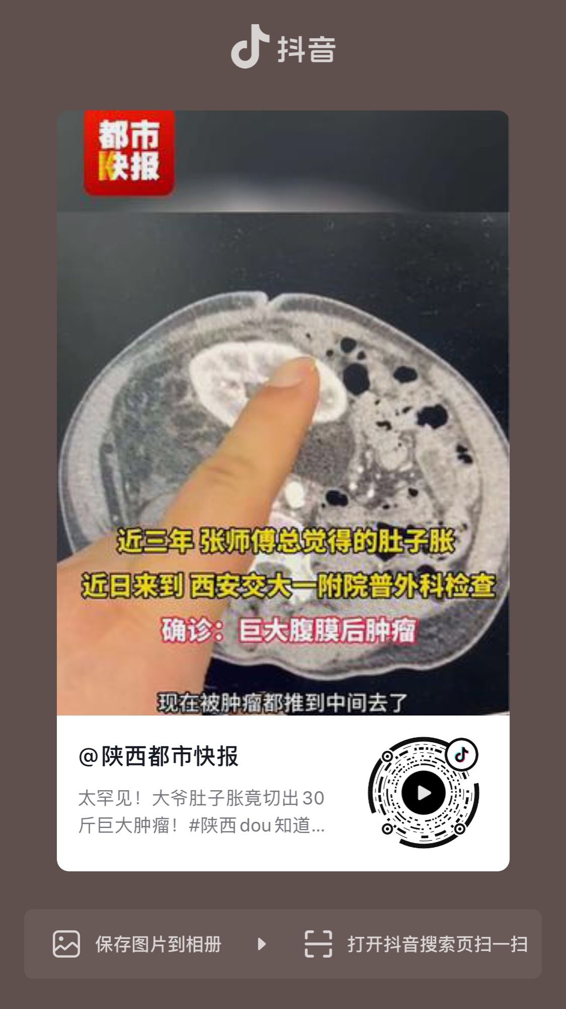 http://www.dyyy.xjtu.edu.cn/__local/C/75/EC/9190BE7BA4D4C20338787744BB7_71EFAE2C_2CEAA.jpeg http://www.dyyy.xjtu.edu.cn/__local/C/75/EC/9190BE7BA4D4C20338787744BB7_71EFAE2C_2CEAA.jpeg